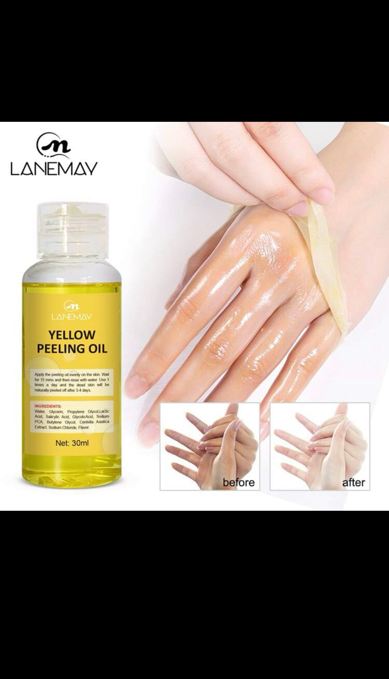 YELLOW PEELING OIL Minoustore